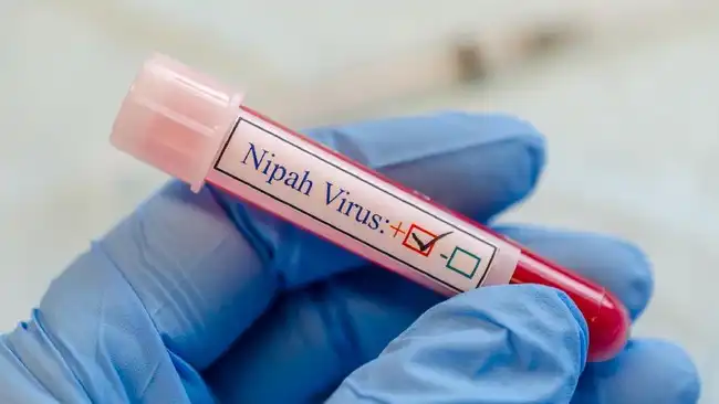 Ilustrasi Virus Nipah